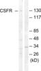 Colony Stimulating Factor 1 Receptor antibody, LS-C117865, Lifespan Biosciences, Western Blot image 