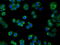 Pim-2 Proto-Oncogene, Serine/Threonine Kinase antibody, GTX83887, GeneTex, Immunofluorescence image 