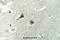 Valosin Containing Protein antibody, A00610-1, Boster Biological Technology, Immunohistochemistry paraffin image 