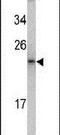 MCTS1 Re-Initiation And Release Factor antibody, PA5-13608, Invitrogen Antibodies, Western Blot image 