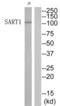 Spliceosome Associated Factor 1, Recruiter Of U4/U6.U5 Tri-SnRNP antibody, abx014969, Abbexa, Western Blot image 