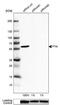 FYN Proto-Oncogene, Src Family Tyrosine Kinase antibody, NBP1-82685, Novus Biologicals, Western Blot image 