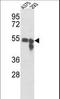 Tyrosinase antibody, LS-C100525, Lifespan Biosciences, Western Blot image 