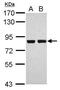 Ribosomal Protein S6 Kinase A3 antibody, GTX111302, GeneTex, Western Blot image 