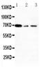 X-Ray Repair Cross Complementing 1 antibody, PA1639, Boster Biological Technology, Western Blot image 