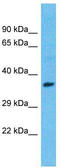 ISL LIM Homeobox 1 antibody, TA329238, Origene, Western Blot image 