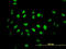 Serine/threonine-protein kinase tousled-like 2 antibody, LS-C133672, Lifespan Biosciences, Immunofluorescence image 