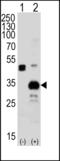 Autophagy Related 5 antibody, LS-B11793, Lifespan Biosciences, Western Blot image 