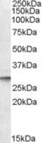 Dolichyl-Phosphate Mannosyltransferase Subunit 1, Catalytic antibody, PA5-19027, Invitrogen Antibodies, Western Blot image 