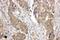 LIM and SH3 domain protein 1 antibody, PA1791, Boster Biological Technology, Immunohistochemistry frozen image 