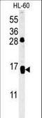 CD69 Molecule antibody, LS-C168556, Lifespan Biosciences, Western Blot image 