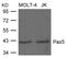 Paired Box 5 antibody, 79-762, ProSci, Western Blot image 