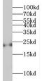 Mediator of RNA polymerase II transcription subunit 20 antibody, FNab05092, FineTest, Western Blot image 