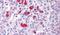 Beta-Secretase 1 antibody, PA5-32670, Invitrogen Antibodies, Immunohistochemistry paraffin image 
