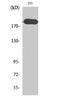 TSC Complex Subunit 2 antibody, STJ96139, St John