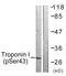 Troponin I3, Cardiac Type antibody, LS-C199668, Lifespan Biosciences, Western Blot image 