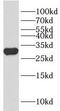 Homeobox D12 antibody, FNab03985, FineTest, Western Blot image 