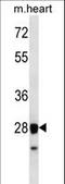 Syntaxin 8 antibody, LS-C161595, Lifespan Biosciences, Western Blot image 