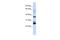Transmembrane Protein 255A antibody, A16933, Boster Biological Technology, Western Blot image 