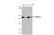 SWI/SNF Related, Matrix Associated, Actin Dependent Regulator Of Chromatin, Subfamily A, Member 2 antibody, GTX636330, GeneTex, Western Blot image 