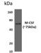 Colony Stimulating Factor 1 antibody, GTX52921, GeneTex, Western Blot image 