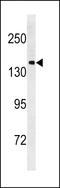 Protocadherin 11 Y-Linked antibody, LS-C203836, Lifespan Biosciences, Western Blot image 