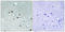 Chromobox 5 antibody, LS-C118344, Lifespan Biosciences, Immunohistochemistry paraffin image 