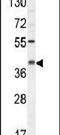 Complement C5a Receptor 1 antibody, PA5-24194, Invitrogen Antibodies, Western Blot image 