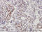 Ribosomal RNA Processing 9, U3 Small Nucleolar RNA Binding Protein antibody, LS-C133106, Lifespan Biosciences, Immunohistochemistry frozen image 