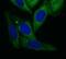 Acyl-CoA Thioesterase 2 antibody, FNab00091, FineTest, Immunofluorescence image 