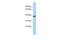 Insulin Induced Gene 1 antibody, GTX47437, GeneTex, Western Blot image 