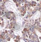 Stathmin 1 antibody, AP0220, ABclonal Technology, Immunohistochemistry paraffin image 