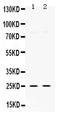 Thymidine Kinase 1 antibody, PB9832, Boster Biological Technology, Western Blot image 