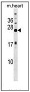 Potassium Voltage-Gated Channel Interacting Protein 4 antibody, AP52308PU-N, Origene, Western Blot image 