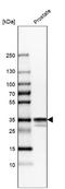 CNN1 antibody, NBP1-87029, Novus Biologicals, Western Blot image 