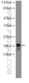 Acid Phosphatase 1 antibody, 22214-1-AP, Proteintech Group, Western Blot image 