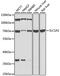 Solute Carrier Family 1 Member 2 antibody, STJ29823, St John