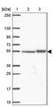 Transmembrane Protein 246 antibody, PA5-62901, Invitrogen Antibodies, Western Blot image 