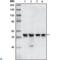 Checkpoint Kinase 1 antibody, LS-C812425, Lifespan Biosciences, Western Blot image 