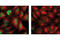 Signal Transducer And Activator Of Transcription 5A antibody, 9314S, Cell Signaling Technology, Immunofluorescence image 