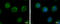 Charged multivesicular body protein 5 antibody, GTX106692, GeneTex, Immunocytochemistry image 
