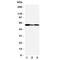 G Protein-Coupled Estrogen Receptor 1 antibody, R31359, NSJ Bioreagents, Western Blot image 