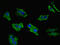 LIM Zinc Finger Domain Containing 1 antibody, LS-C675993, Lifespan Biosciences, Immunofluorescence image 