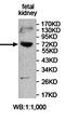Adenosine Monophosphate Deaminase 3 antibody, orb78024, Biorbyt, Western Blot image 