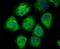 Melanoma Cell Adhesion Molecule antibody, NBP2-80441, Novus Biologicals, Immunofluorescence image 