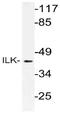 Integrin-linked protein kinase antibody, AP21113PU-N, Origene, Western Blot image 