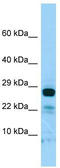 Interleukin-22 receptor subunit alpha-2 antibody, TA337940, Origene, Western Blot image 