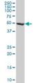 F-Box And Leucine Rich Repeat Protein 3 antibody, H00026224-M03, Novus Biologicals, Western Blot image 