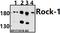 Rho Associated Coiled-Coil Containing Protein Kinase 1 antibody, A00722-2, Boster Biological Technology, Western Blot image 