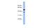 Wnt Family Member 3A antibody, PA5-44946, Invitrogen Antibodies, Western Blot image 